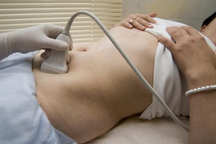 Što je ektopična trudnoća i koliko je to opasno?